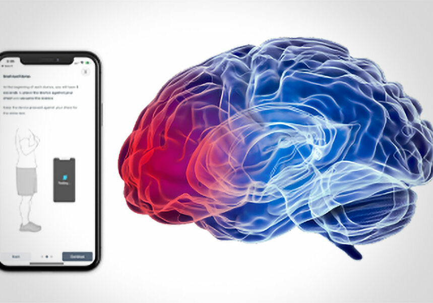 concussion-testing